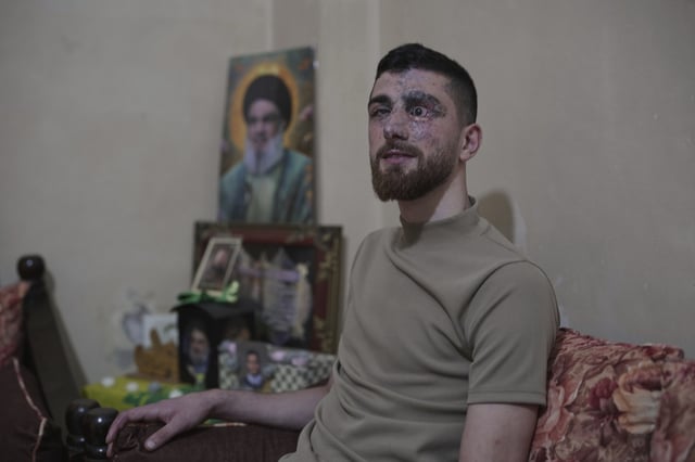 AP’s Hezbollah “Pager Survivor” Story Omits Terror Ties, Focuses on Sympathy