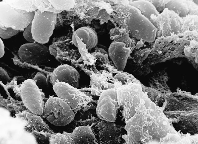 Undated handout image provided by Rocky Mountain Laboratories showing an electron micrograph depicting a mass of Yersinia pestis bacteria (the cause of bubonic plague). (AP Photo/Rocky Mountain Laboratories)