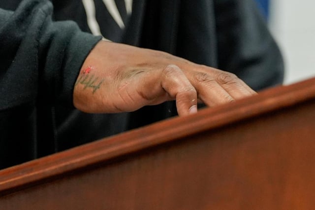 La foto del jueves 7 de agosto de 2025 muestra la mano lesionada del quarterback de los Colts de Indianápolis, Anthony Richardson (AP Foto/Alex Brandon)