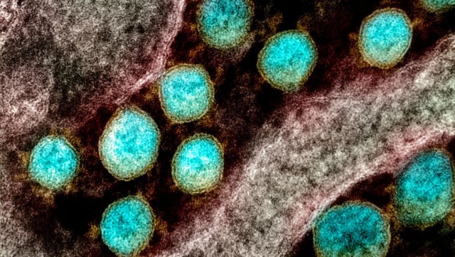 We Still Don’t Fully Know What Long COVID Actually Is – And That’s A Problem