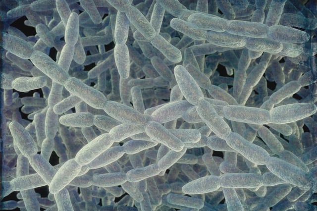 Stock image of the bacteria that causes Legionnaires' disease, a severe pneumonia.
