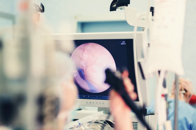 endoscopy examination procedure with endoscope equipment in surgical room endoscopic exam with latest technology