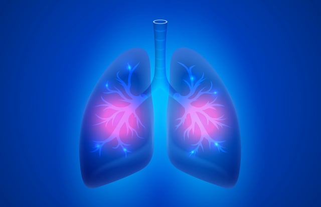 Around 500,000 people in the US are estimated to have NCFB, according to Insmed. Credit: HobbitArt via Shutterstock.com.