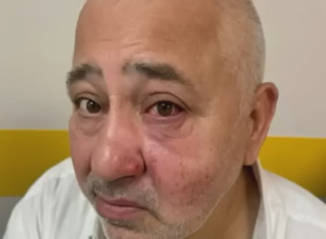 Jewish Man Attacked, Star of David Necklace Stolen in Paris Suburb