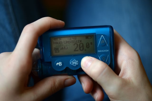 Illustration - A young girl, suffering from diabetes type 1, sets the bolus of her insulin pump which monitors the consumption of carbohydrates in her body in Berlin, Germany, 19 February 2014. The catheter is connected to an insulin pump which provides a regular supply of insuline to her body. Photo by: Jens Kalaene/picture-alliance/dpa/AP Images