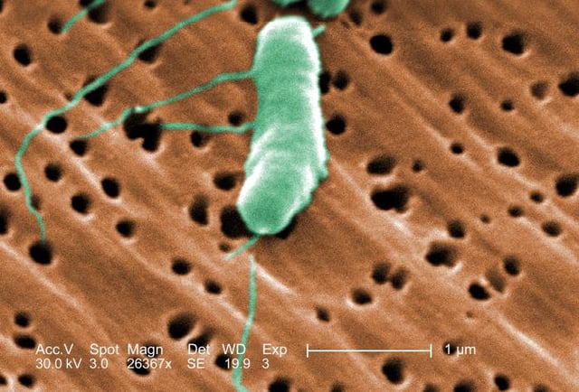 A Vibrio vulnificus cell
