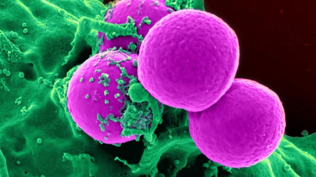 Scientists hope AI could solve the growing threat of antibiotic resistance