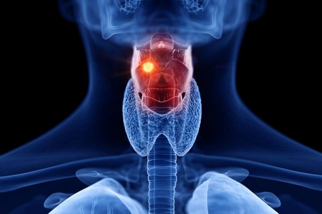 Voice box cancer detection 