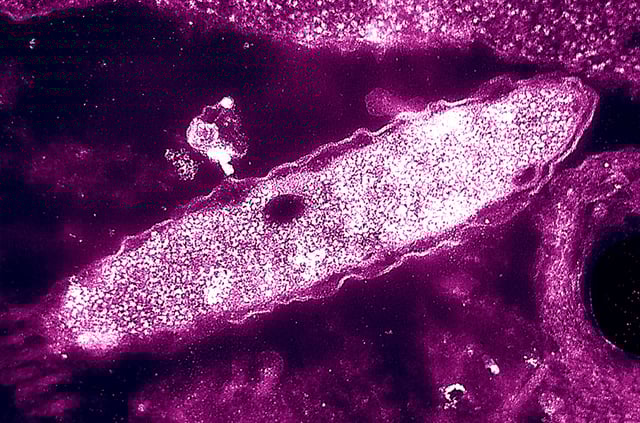 Legionella Pneumophila Colorized Tem, Approximately X 129 500, Cultured In An Embryonated HenS Egg. Legionella Pneumophila Is A Gram Negative Bacillus, Strict Aerobic. This Is An Ubiquitous Aquatic And Facultative Intracellular Bacterium, Responsible For Legionaire Disease Legionellosis And Pontiac Fever. Legionella Pneumophila > Legionella > Legionellaceae > Legionellales > Proteobacteria > Bacterium. This Thin Section Transmission Electron Micrograph Tem Depicted A Gram Negative Legionella Pneumophila Bacterium, Which Was Cultured In An Embryonated HenS Egg; Magnified Approximately 119,500X. At Least 46 Legionella Spp. , And 70 Serogroups Have Been Identified. L. Pneumophila, An Ubiquitous Aquatic Bacterial Organism, Which Thrives In Warm Environments, Primarily At Temperatures Ranging From 32° 45°C, And Causes Over 90% Of Legionnaires' Disease, Ld, In The United States. Legionnaires' Disease, Ld, Is The More Severe Form Of Legionellosis And Is Characterized By Pneumonia, Commencing 2 10 Days After Exposure. Pontiac Fever Is An Acute Onset, Flu Like, Non Pneumonic Illness, Occuring Within A Few Hours To Two Days Of Exposure. (Photo By BSIP/UIG Via Getty Images)