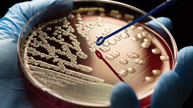 Cases of MRSA may be rising, but are still at low levels compared with their last peak in the early 2000s