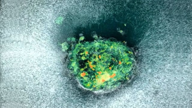 Forscher filmen erstmals, wie ein Embryo sich in die Gebärmutterschleimhaut einnistet.