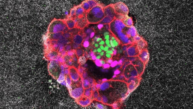 First-Of-Its-Kind Footage Shows Human Embryo Implantation In Real-Time