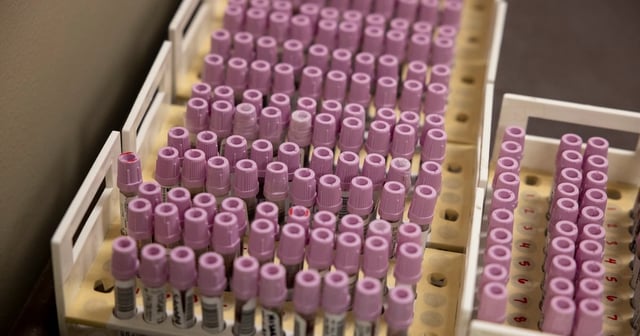 Patient blood samples seen on May 1, 2025 that are ready for testing at the Texas Department of State Health Services Laboratory.