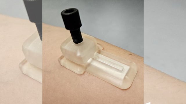 Researchers have developed a microneedle patch to monitor a range of health biomarkers without drawing blood or relying on batteries or external devices. In proof-of-concept testing with synthetic skin, the researchers demonstrated that the patches could collect biomarker samples in as little as 15 minutes.