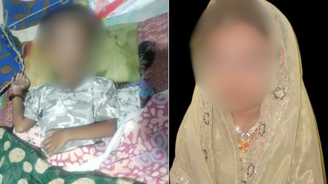 4-year-old girl dies of rabies after stray dog attack in Davangere, Karnataka reports 2.86 lakh dog bite cases in 2025.