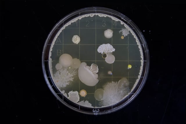 AI designs new antibiotics to combat drug-resistant superbugs