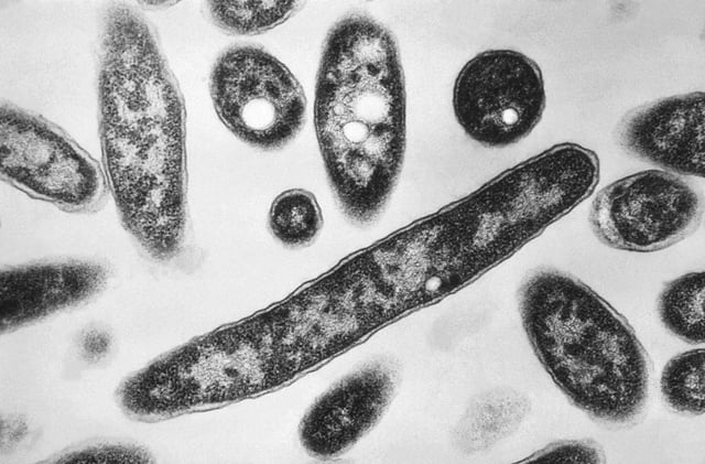ARCHIVO – En esta imagen obtenida en 1978 mediante un microscopio electrónico y divulgada por los Centros para el Control y la Prevención de Enfermedades (CDC, por sus siglas en inglés) se muestra la bacteria Legionella pneumophila, responsable de la legionelosis o enfermedad del legionario. (Francis Chandler/CDC vía AP, Archivo)
