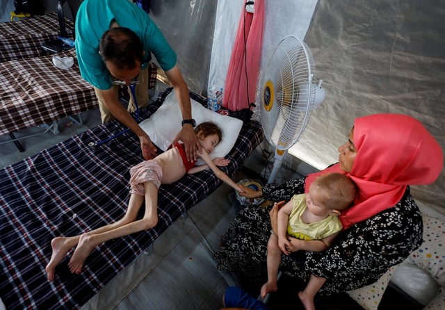 A doctor checks Palestinian girl Jana Ayad, who is malnourished, according to medics, as she receives treatment at the International Medical Corps field hospital, amid the Israel-Hamas conflict, in Deir Al-Balah in the southern Gaza Strip, June 22, 2024. REUTERS/Mohammed Salem/File Photo     TPX IMAGES OF THE DAY