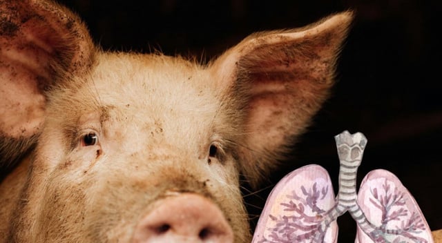 primer trasplante de pulmón de cerdo a humano Foto Canva