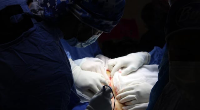 Equipo médico del IMSS durante una cirugía compleja para extraer un tumor ovárico de gran tamaño. La imagen muestra a varios especialistas trabajando de forma coordinada con iluminación focalizada sobre el área abdominal de la paciente, destacando la precisión y profesionalismo del procedimiento quirúrgico.