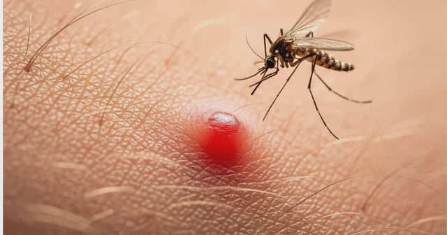 El dengue registra 6 mil 923 casos en México. Canva/Imagen con IA.