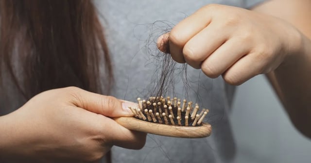 Señales de alopecia y qué puedes hacer para frenarla. Foto: Canva.