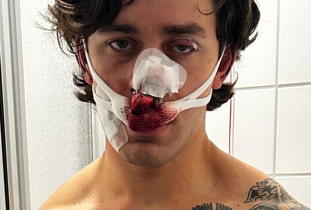Mr Rudat suffered injuries to his face after saving two women from being attacked in Germany.