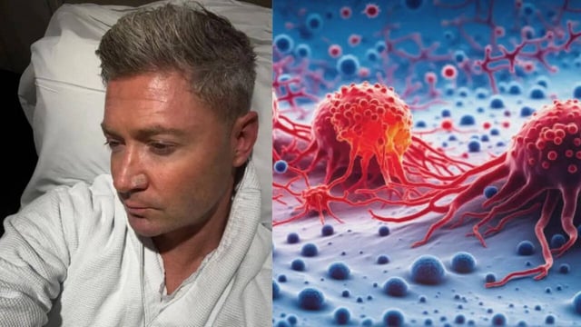 Michael Clarke's Skin Cancer Battle, All You Need to Know About the Disease