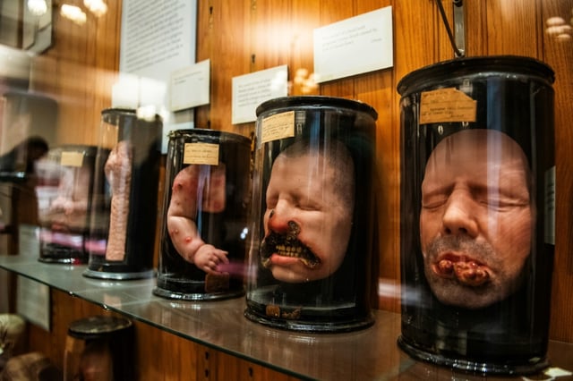 Des moulages en cire de patients souffrant de diverses maladies de la peau et du visage au Mütter Museum, à Philadelphie, le 20 août 2025 en Pennsylvanie