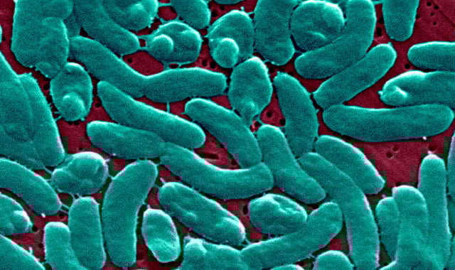 An electron micrograph of Vibrio Vulnificus bacteria.
