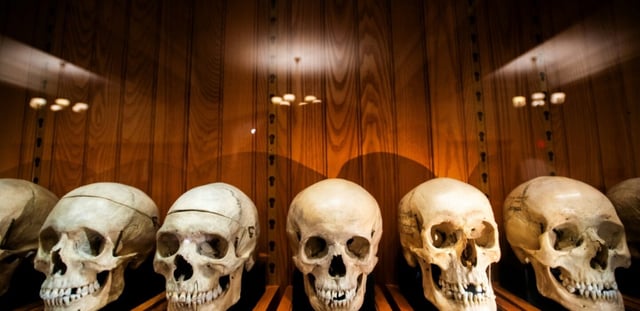 La collection de crânes d'un anatomiste autrichien au Mütter Museum de Philadelphie, le 20 août 2025 en Pennsylvanie