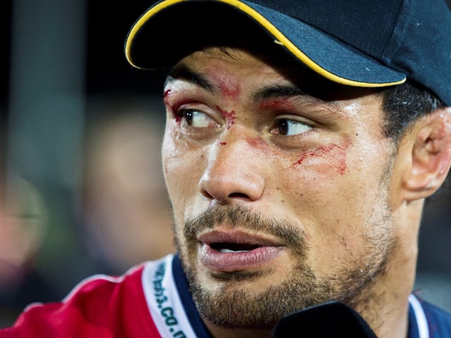 Shane Christie reacts following his game for the Tasman Makos in Nelson, New Zealand, Oct. 18, 2014. (Alden Williams/Stuff via AP)