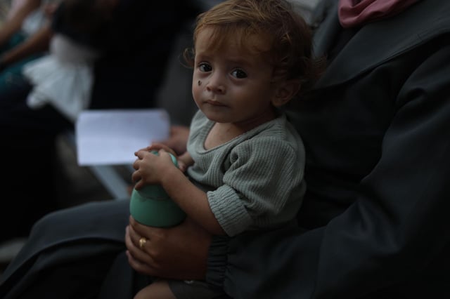 Adam Zanoun, de un año, sufre de malnutrición severa en Gaza