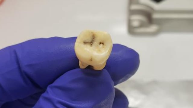 A researcher holds a Jerash tooth used to help identify the origin of the first plague.