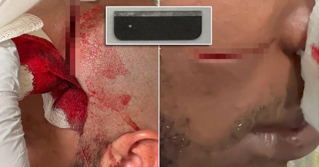 Two officers with the Correction Department's Emergency Service Unit were badly slashed by a notoriously violent detainee late Wednesday on Rikers Island. The attacker used a ceramic scalpel (inset). (COBA)