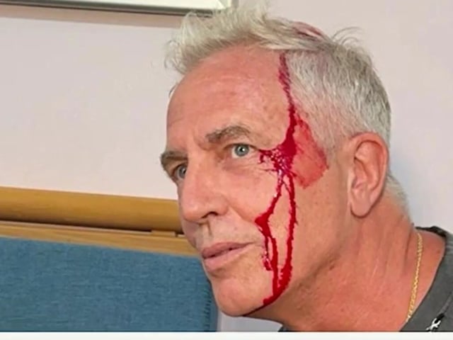 Marley se accidentó en Tailandia. Fotos: Captura TV.