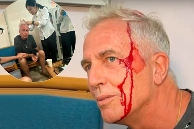 El accidente de Marley en Por el mundo. Foto: captura pantalla