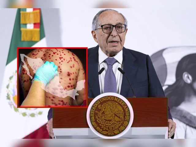 El secretario de Salud, David Kershenobich, informó sobre un aumento en casos de sarampión en México 2025: Hay más de 4 mil casos y 17 muertes. | Crédito: Presidencia/Canva