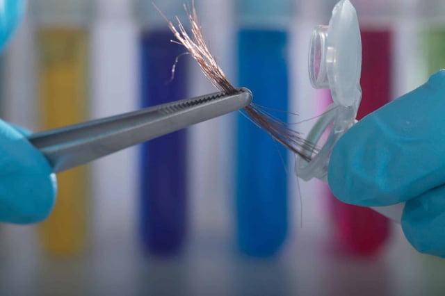 Scientists believe hair samples could potentially help yield earlier ALS diagnoses. (Photo by Tonhom1009 on Shutterstock)