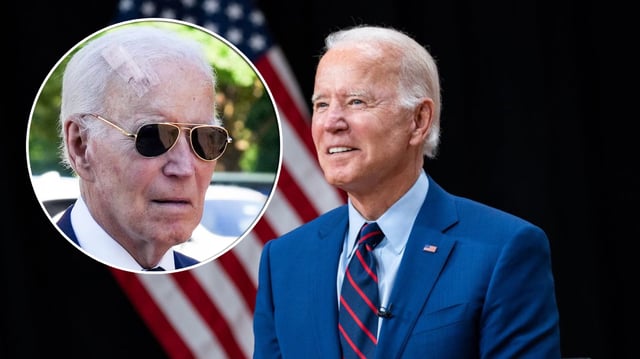El ex presidente Joe Biden fue sometido recientemente a una cirugía conocida como Mohs. FOTO: Especial
