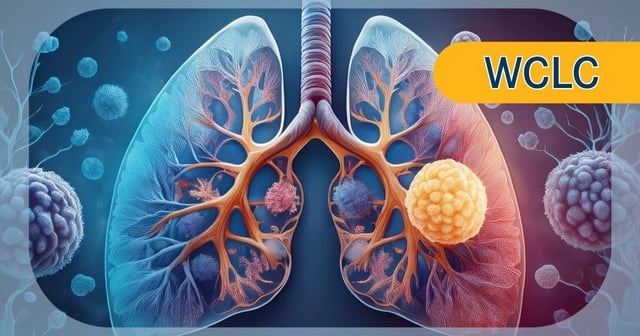 CheckMate 77T QOL Data Further Support Perioperative Nivolumab in Resectable NSCLC