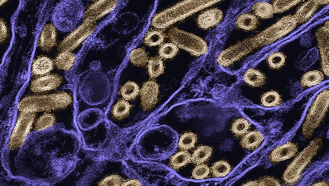 With A New Drug Cocktail, Scientists May Have Finally Found Flu’s Universal Weak Spot