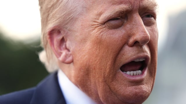 President Donald Trump has, in the past, been seen with a bruise on his hand, sparking health concerns. 