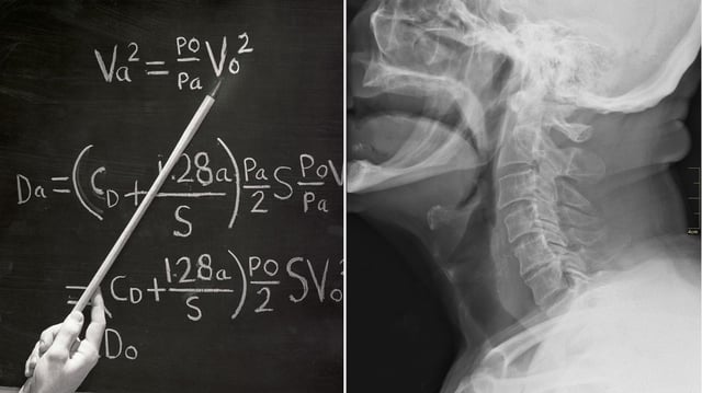 Researchers have made a mathematical model that can pinpoint swallowing difficulties