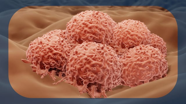 Path Toward Accelerated Approval of RP1 in Advanced Melanoma Remains Unclear After FDA Type A Meeting