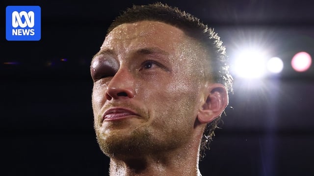 Liam Paro with a big black eye after his fight.