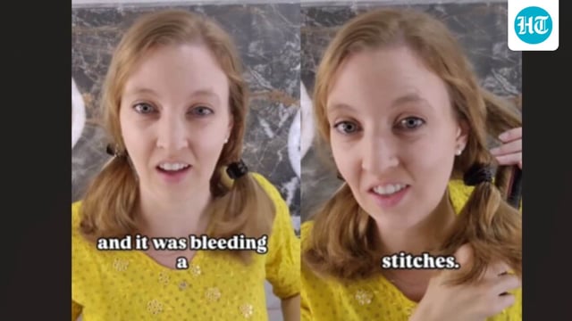 An American woman recounted how her thumb injury was treated in India for just ₹50.