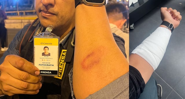 Producto del golpe, el gráfico terminó con el brazo lastimado y tuvo que ser atendido en una clínica. Junto con él, otros reporteros gráficos también denunciaron haber sido maltratados.