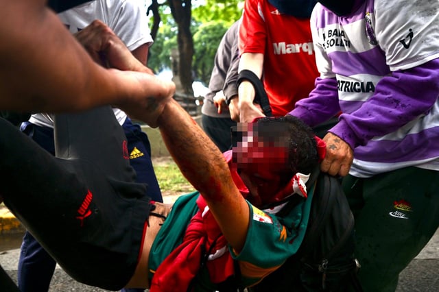 El fotógrafo Pablo Grillo fue herido de gravedad durante la marcha de los jubilados el 12 de marzo de 2025