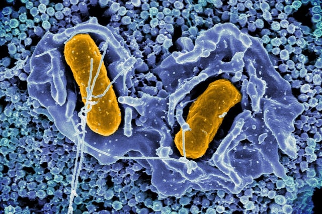 Scientists have engineered a species of Salmonella that self-destructs inside colon cancer tumors